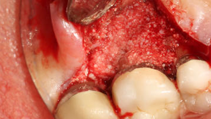 Content Dam Sr Online Articles 2018 10 18oct11piaclintipt