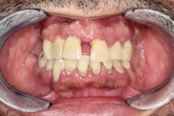 18nov8piaclintip01 18nov8piaclintip01