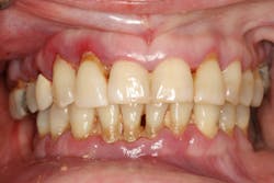 18nov8piaclintip02 18nov8piaclintip02