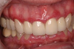 18nov8piaclintip04 18nov8piaclintip04