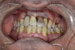 18nov8piaclintip05 18nov8piaclintip05