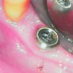 18nov8piawingrove01a 18nov8piawingrove01a