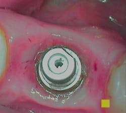 18nov8piawingrove01b 18nov8piawingrove01b