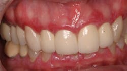 Content Dam Sr Online Articles 2018 11 18nov8piaclintipt Content Dam Sr Online Articles 2018 11 18nov8piaclintipt