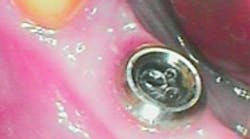 Content Dam Sr Online Articles 2018 11 18nov8piawingrovet Content Dam Sr Online Articles 2018 11 18nov8piawingrovet