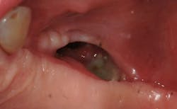 Ao Piapreview Article1 Valentini Dec2018 Fig1a Ao Piapreview Article1 Valentini Dec2018 Fig1a