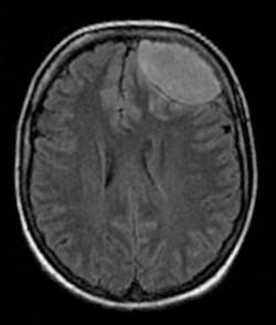 Ao Piapreview Article1 Valentini Dec2018 Fig2a Ao Piapreview Article1 Valentini Dec2018 Fig2a