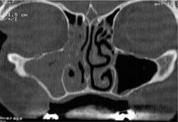 Ao Piapreview Article1 Valentini Dec2018 Fig3a Ao Piapreview Article1 Valentini Dec2018 Fig3a