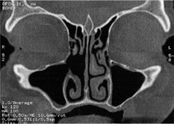 Ao Piapreview Article1 Valentini Dec2018 Fig4a Ao Piapreview Article1 Valentini Dec2018 Fig4a
