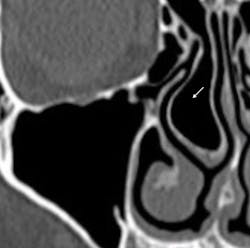 Ao Piapreview Article1 Valentini Dec2018 Fig5a Ao Piapreview Article1 Valentini Dec2018 Fig5a