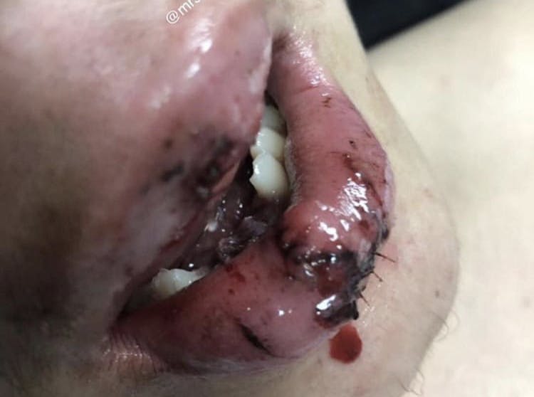 1903defro P01 1903defro P01