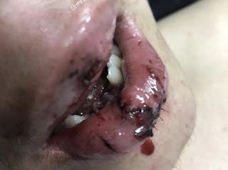 1903defro P01 1903defro P01