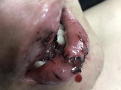 1903defro P01 1903defro P01