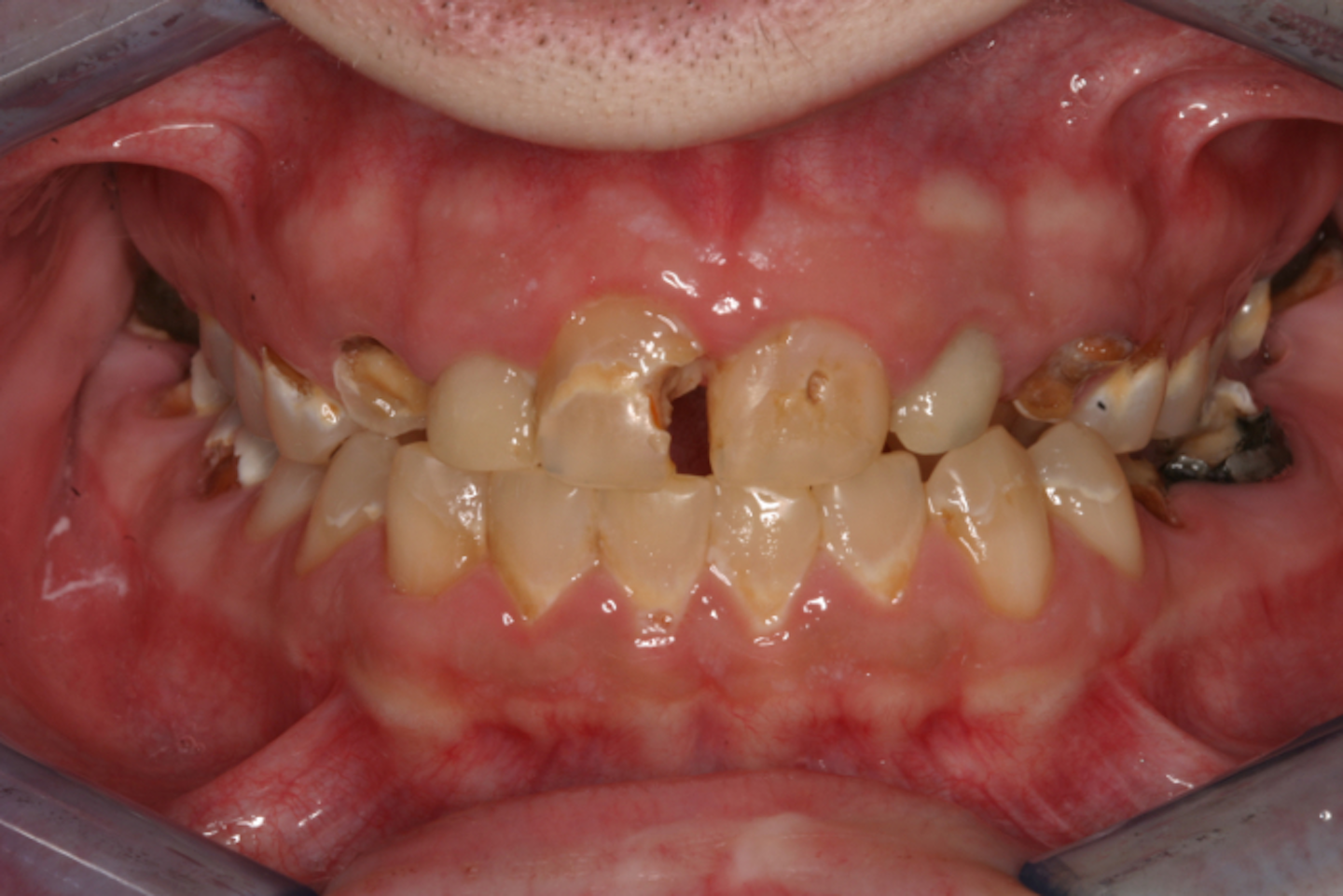 14+ History Of Present Illness Dental Example Pics