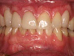 Content Dam Diq Online Articles 2012 August Antimprest Content Dam Diq Online Articles 2012 August Antimprest