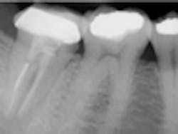 Content Dam Diq Online Articles 2012 July Endovsimptrmt Content Dam Diq Online Articles 2012 July Endovsimptrmt