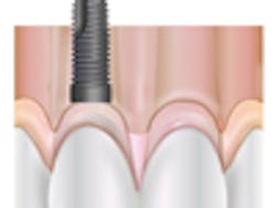 Content Dam Diq Online Articles 2012 July Impmandc Content Dam Diq Online Articles 2012 July Impmandc