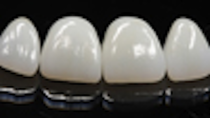 Content Dam Diq Online Articles 2013 05 Restorations