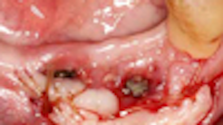 Content Dam Diq Online Articles 2014 05 14may8srryoobearfgg Small