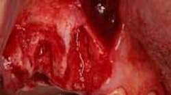 Content Dam Diq Online Articles 2015 02 15srrfeb26froumsocketbone03a Article Thumbnail Content Dam Diq Online Articles 2015 02 15srrfeb26froumsocketbone03a Article Thumbnail