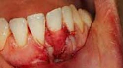 Content Dam Diq Online Articles 2015 03 15mar26srrfroum Perioregen02 Article Thumbnail Content Dam Diq Online Articles 2015 03 15mar26srrfroum Perioregen02 Article Thumbnail