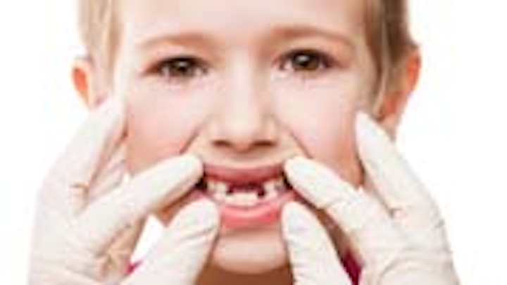Content Dam Diq Online Articles 2015 04 Missing Teeth Thumbnail