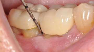 Content Dam Diq Online Articles 2015 05 15may28srrpette Article Thumbnail