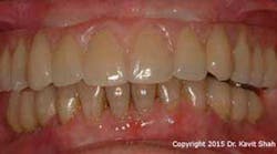 Content Dam Diq Online Articles 2015 06 15jun18padvshah12 Article Thumbnail Content Dam Diq Online Articles 2015 06 15jun18padvshah12 Article Thumbnail