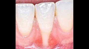 Content Dam Diq Online Articles 2015 07 15padvjul16doobrow Article Thumbnail