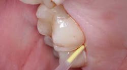 Content Dam Diq Online Articles 2015 07 Periodontitis Content Dam Diq Online Articles 2015 07 Periodontitis