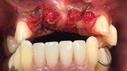 Content Dam Diq Online Articles 2015 08 15aug20piagargiulo Article Thumbnail Content Dam Diq Online Articles 2015 08 15aug20piagargiulo Article Thumbnail