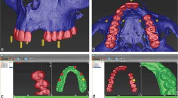 Content Dam Diq Online Articles 2015 09 Ctscanjoi Article Thumbnail