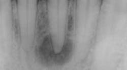 Content Dam Diq Online Articles 2015 10 15oct15pia Clin Tip Froum01 Article Thumbnail Content Dam Diq Online Articles 2015 10 15oct15pia Clin Tip Froum01 Article Thumbnail