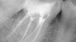 Content Dam Diq Online Articles 2015 10 15oct15pia Mann08 Article Thumbnail Content Dam Diq Online Articles 2015 10 15oct15pia Mann08 Article Thumbnail