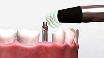 Content Dam Diq Online Articles 2015 10 15oct Askao Article Thumbnail