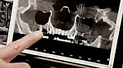 Content Dam Diq Online Articles 2015 11 Cbct Ao 2016 Article Thumb