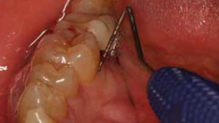Content Dam Diq Online Articles 2015 11 Mange Repair Regenerate Perio Wingrove Thumb