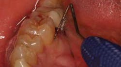 Content Dam Diq Online Articles 2015 11 Mange Repair Regenerate Perio Wingrove Thumb Content Dam Diq Online Articles 2015 11 Mange Repair Regenerate Perio Wingrove Thumb