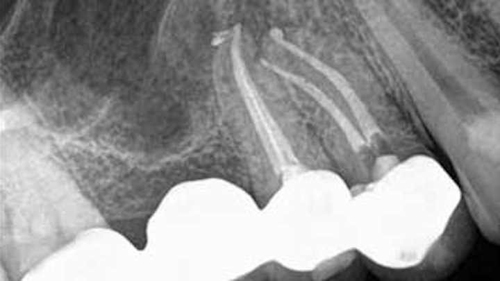 Content Dam Diq Online Articles 2015 11 Nonsurg Endo Cbct Mccormack Thumb
