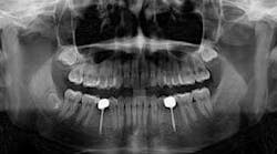 Content Dam Diq Online Articles 2015 11 Pumpkin On A Toothpick Simmons Thumb Content Dam Diq Online Articles 2015 11 Pumpkin On A Toothpick Simmons Thumb