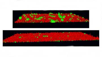 Content Dam Diq Online Articles 2015 12 Bacterial Biofilm With Without Inhibitory Compounds Article Thumbnail