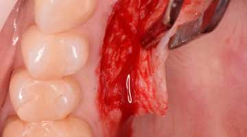 Content Dam Diq Online Articles 2016 01 16piajan21 Tuttle Article Thumb