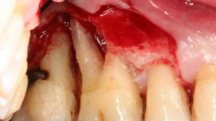Content Dam Diq Online Articles 2016 02 16feb18piafroum Clintip Article Thumbnail