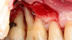 Content Dam Diq Online Articles 2016 02 16feb18piafroum Clintip Article Thumbnail Content Dam Diq Online Articles 2016 02 16feb18piafroum Clintip Article Thumbnail