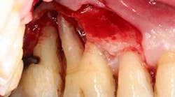 Content Dam Diq Online Articles 2016 02 16feb18piafroum Clintip Article Thumbnail Content Dam Diq Online Articles 2016 02 16feb18piafroum Clintip Article Thumbnail