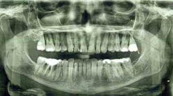 Content Dam Diq Online Articles 2016 02 16feb18piaheilweil Article Thumbnail Content Dam Diq Online Articles 2016 02 16feb18piaheilweil Article Thumbnail