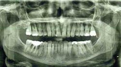 Content Dam Diq Online Articles 2016 02 16feb18piaheilweil Article Thumbnail Content Dam Diq Online Articles 2016 02 16feb18piaheilweil Article Thumbnail