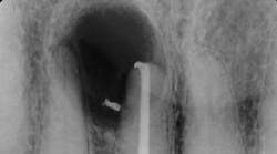 Content Dam Diq Online Articles 2016 05 16may19piafroumt Content Dam Diq Online Articles 2016 05 16may19piafroumt