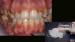 Content Dam Diq Online Articles 2016 07 16jul28piafroumpalamart Content Dam Diq Online Articles 2016 07 16jul28piafroumpalamart