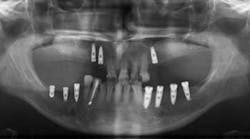 Content Dam Diq Online Articles 2016 07 16jul28piahendersont Content Dam Diq Online Articles 2016 07 16jul28piahendersont